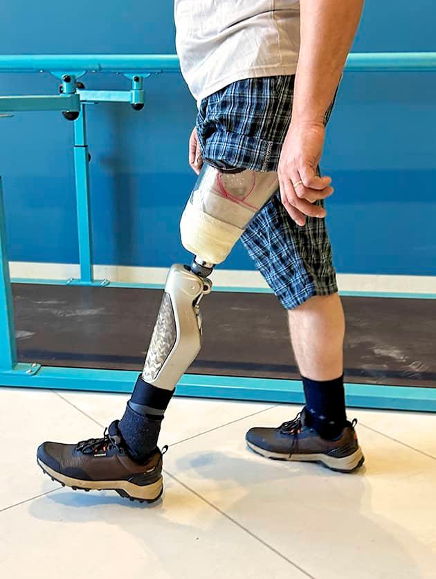 Производство силиконовых изделий для протезирования 